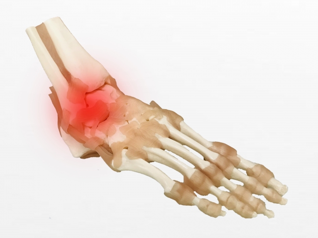 Symptoms and pain of aftereffects of sprain